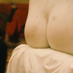 buttocks lifting treatment clayton