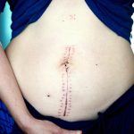 non surgical body shaping selma